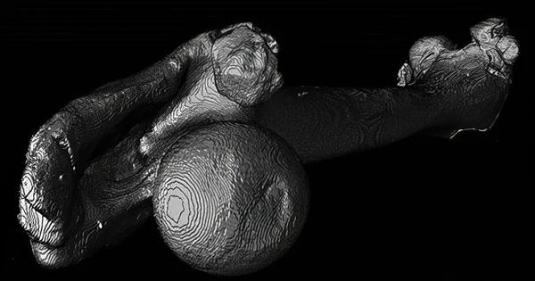 A femur scanned and reconstructed using micro-computed tomography.