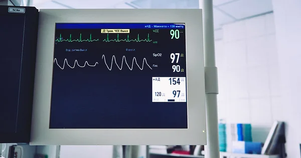 Medical monitor displaying vital signs and heart rate in a clinical setting.